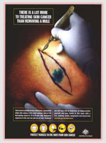 skin cancer from the sun ads.